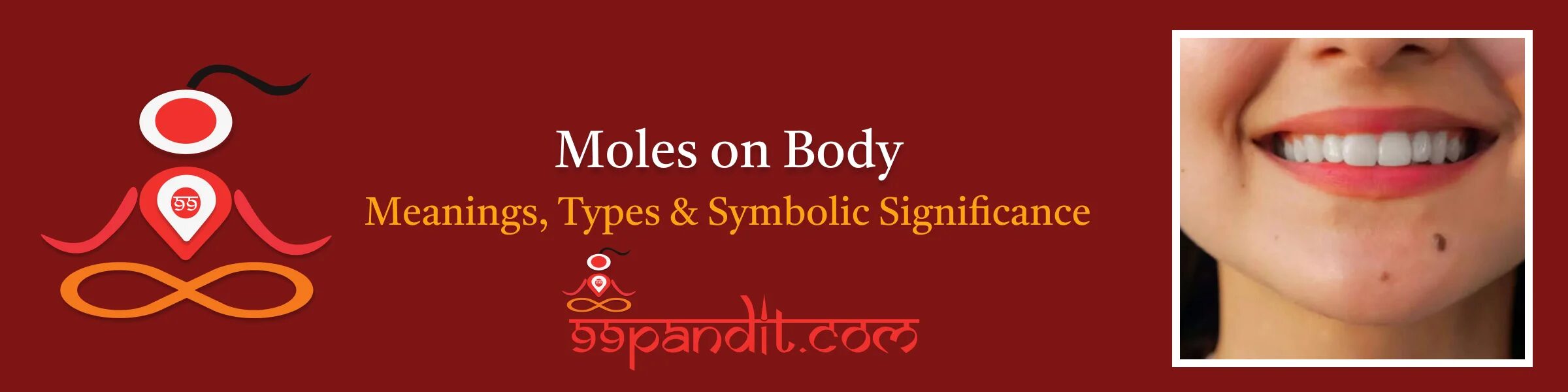 Moles on Body